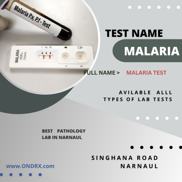 MALARIA TEST